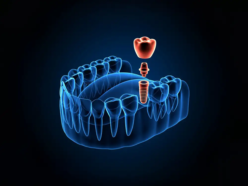 AdobeStock_362244721_Preview Risques orthodontie praticien non spécialisé — consultation spécialiste qualifié Orthodent